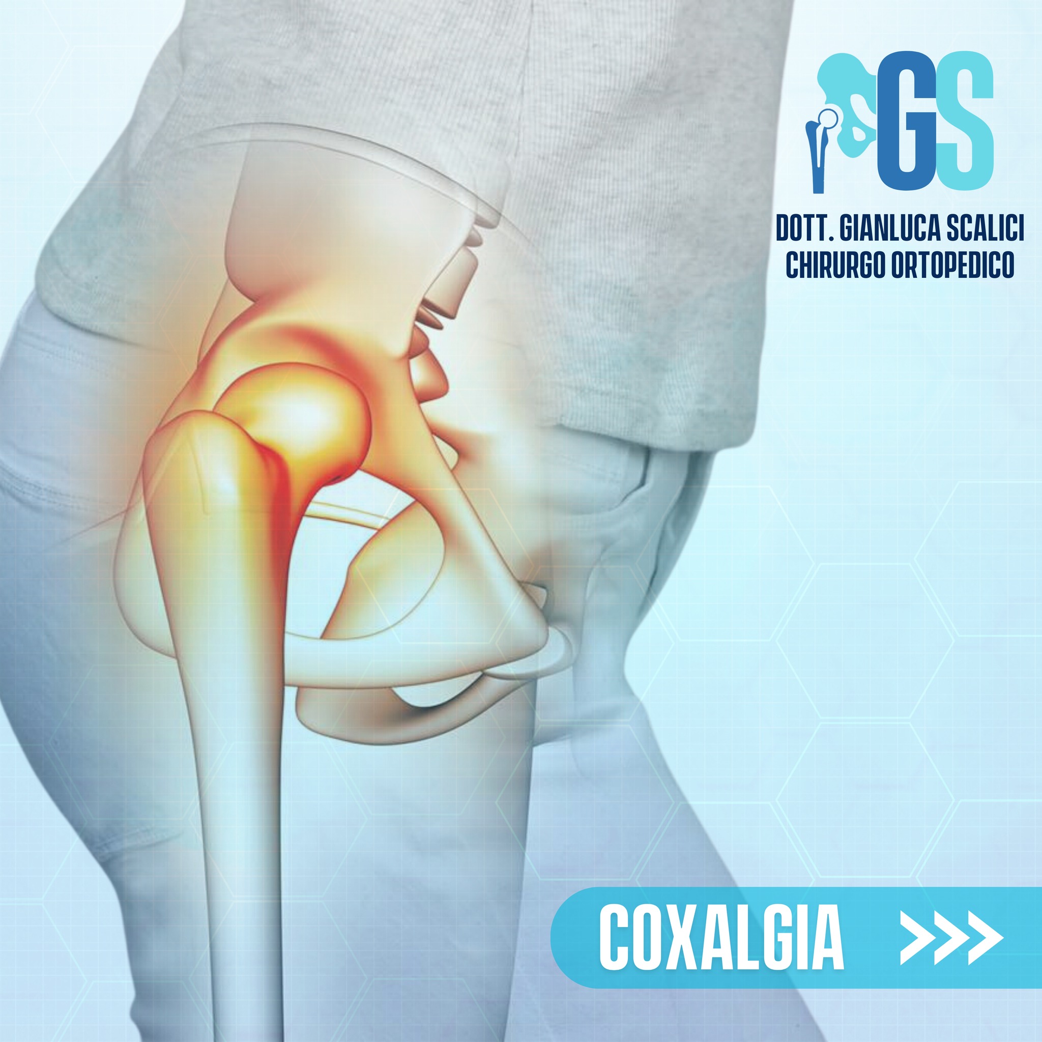 Coxalgia – Consapevolezza e Soluzioni Efficaci